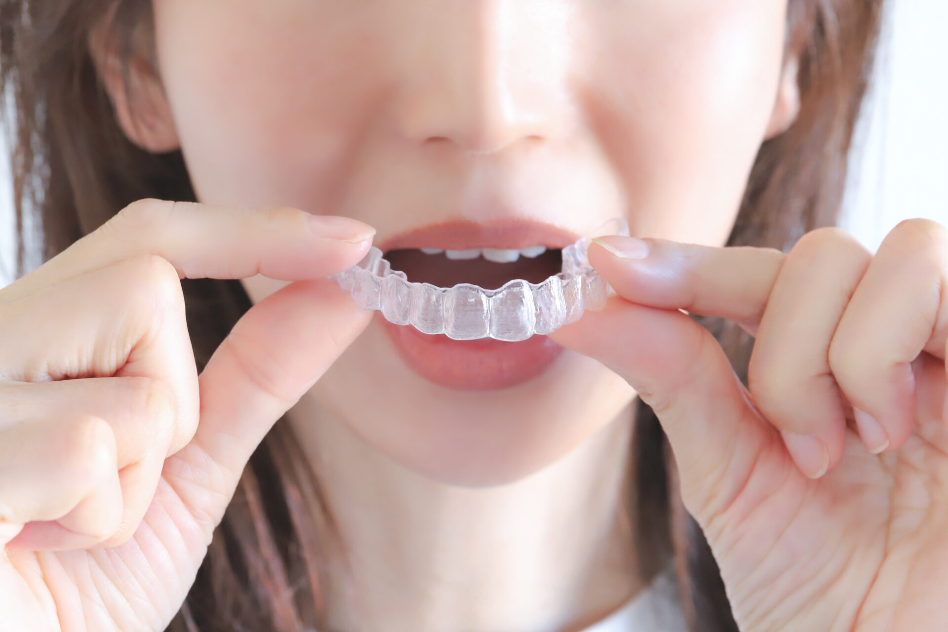 ホームホワイトニング